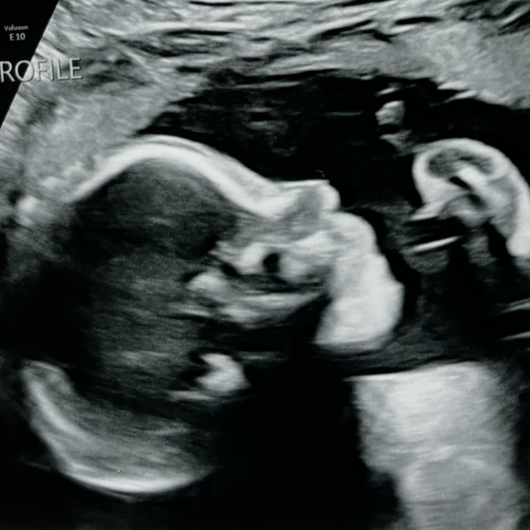 Photo shared by Morgan for their Babylist baby registry.