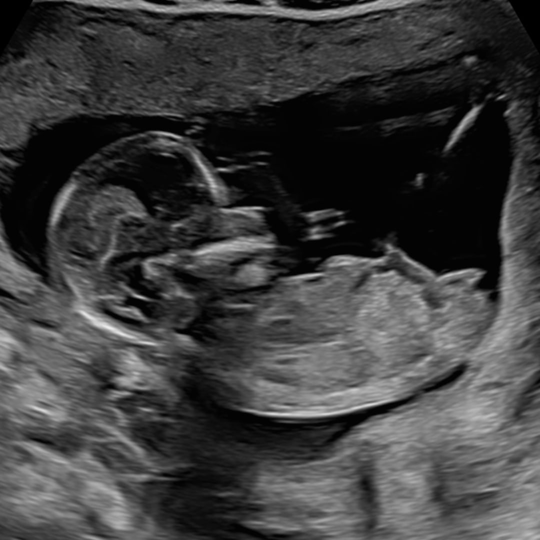 Photo shared by Ellen for their Babylist baby registry.