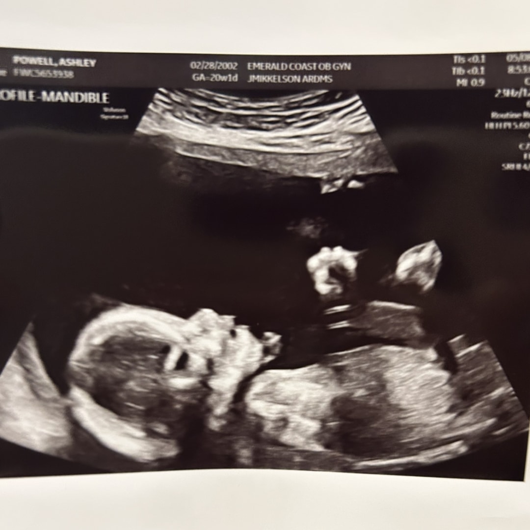 Photo shared by Ashley for their Babylist baby registry.