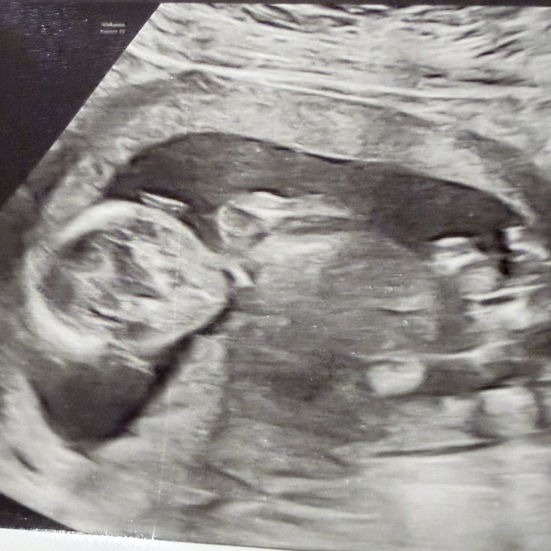 Photo shared by Jess for their Babylist baby registry.