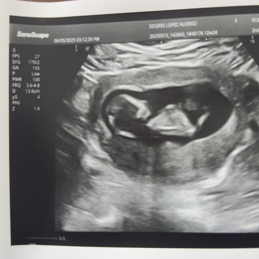 Photo shared by Desiree for their Babylist baby registry.