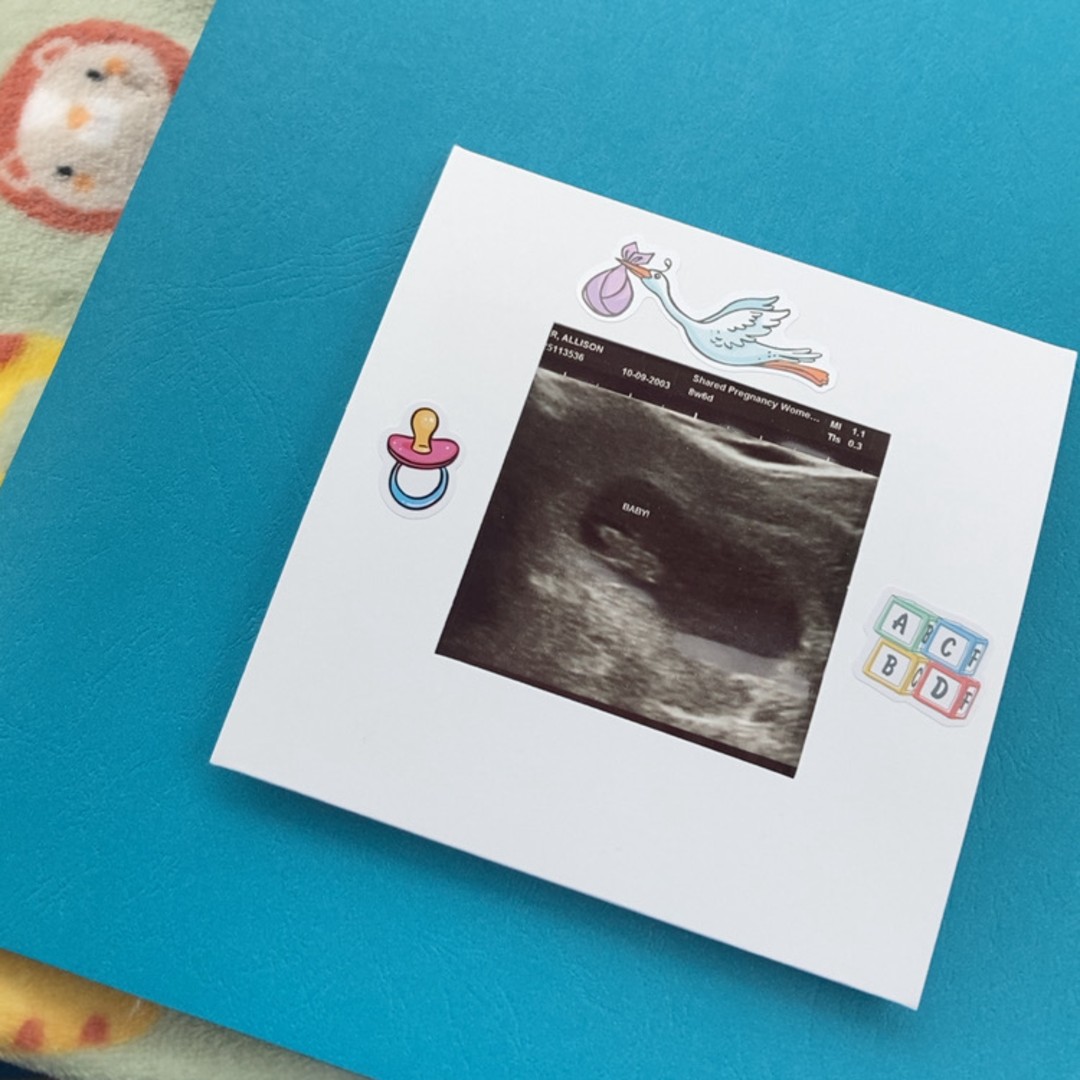 Photo shared by Allison for their Babylist baby registry.