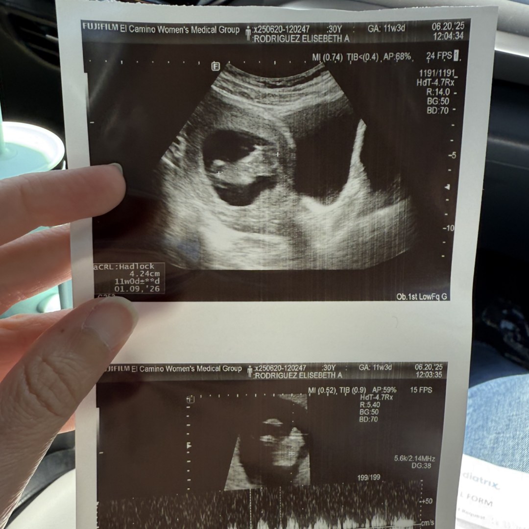 Photo shared by Elisebeth for their Babylist baby registry.