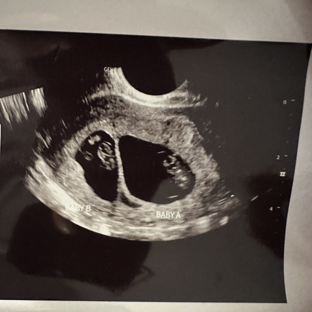Photo shared by Halle for their Babylist baby registry.