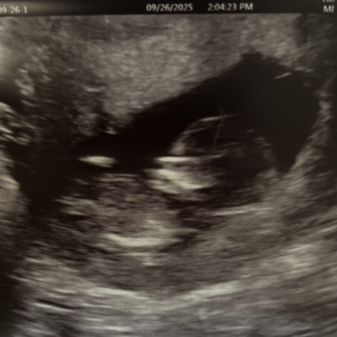 Photo shared by Caitlin for their Babylist baby registry.