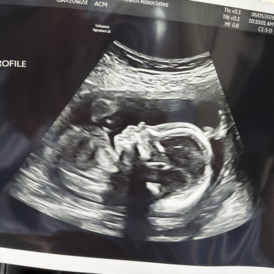 Photo shared by Michaela for their Babylist baby registry.