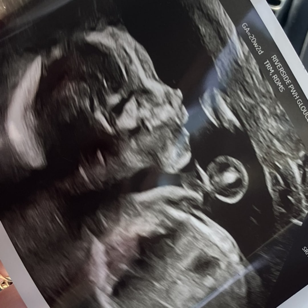 Photo shared by Reaganne for their Babylist baby registry.