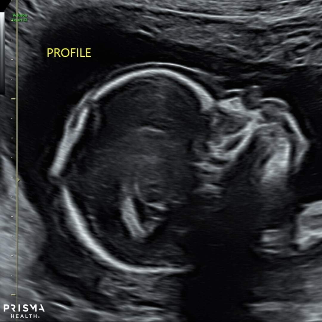 Photo shared by Antiqua for their Babylist baby registry.