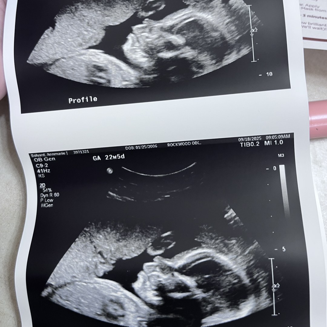 Photo shared by Annmarie for their Babylist baby registry.
