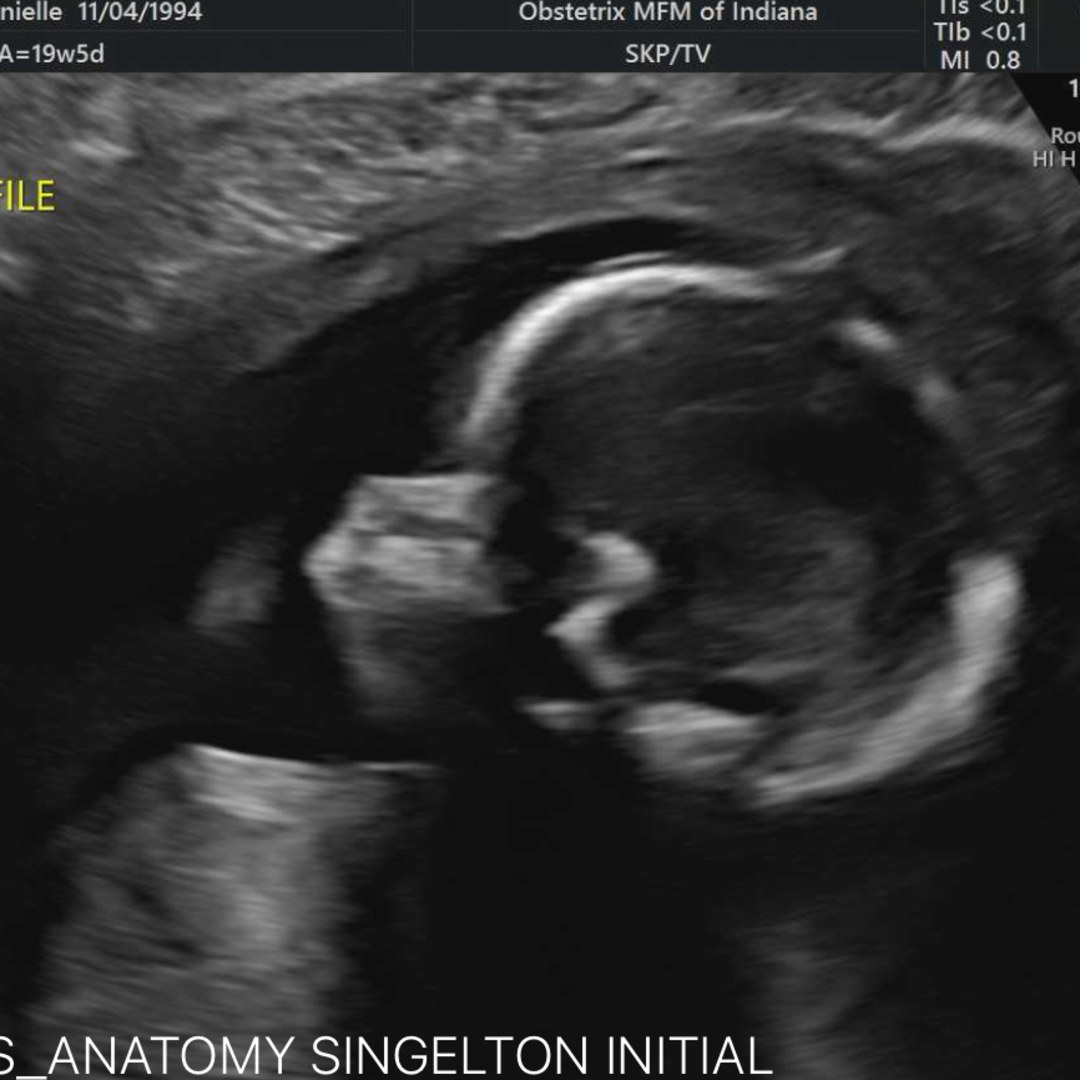 Photo shared by Dani for their Babylist baby registry.
