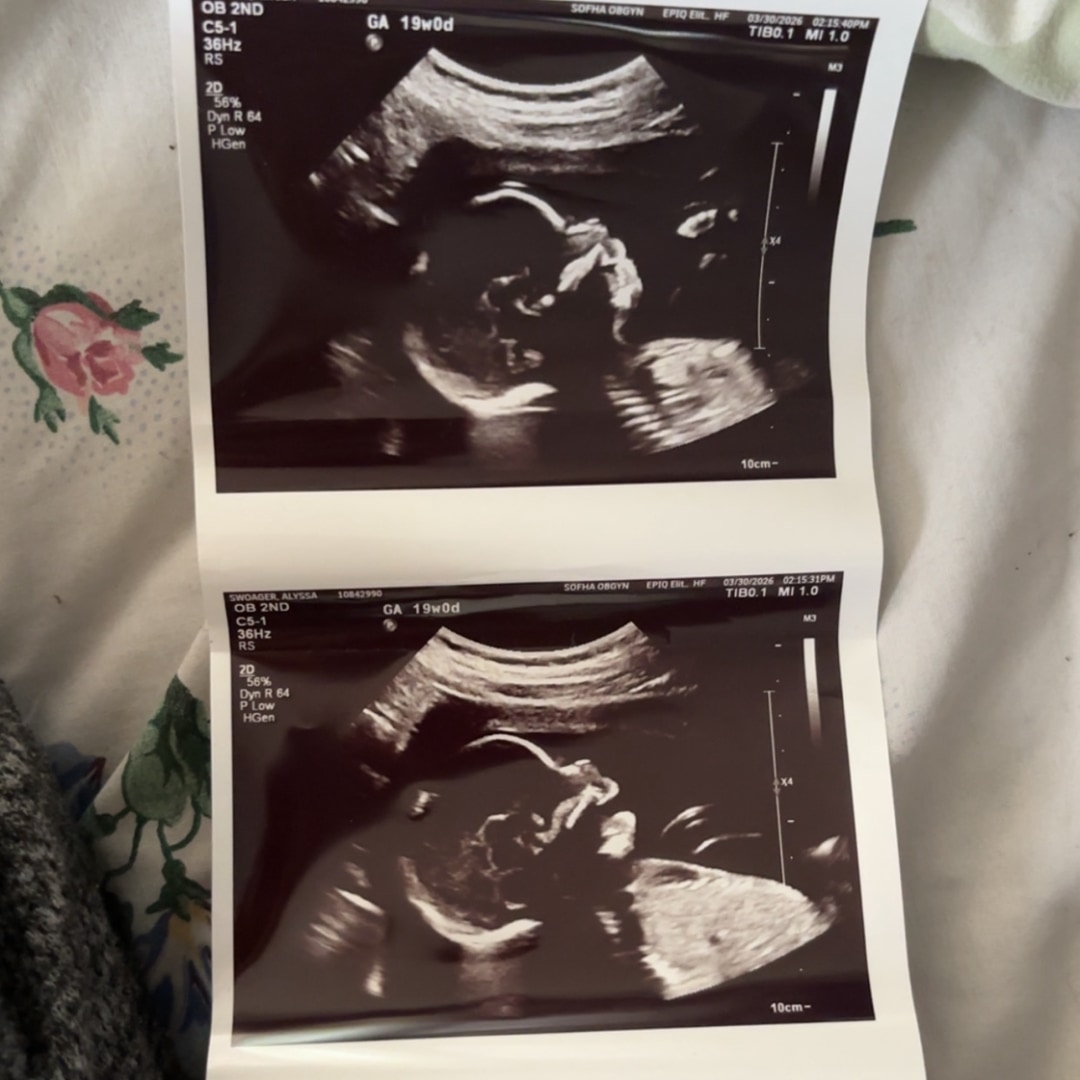 Photo shared by Alyssa for their Babylist baby registry.