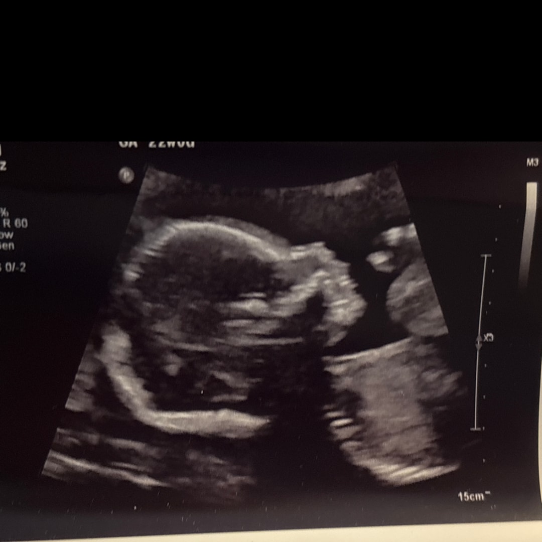 Photo shared by Mary for their Babylist baby registry.