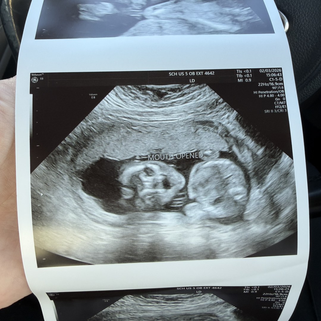 Photo shared by Makayla for their Babylist baby registry.