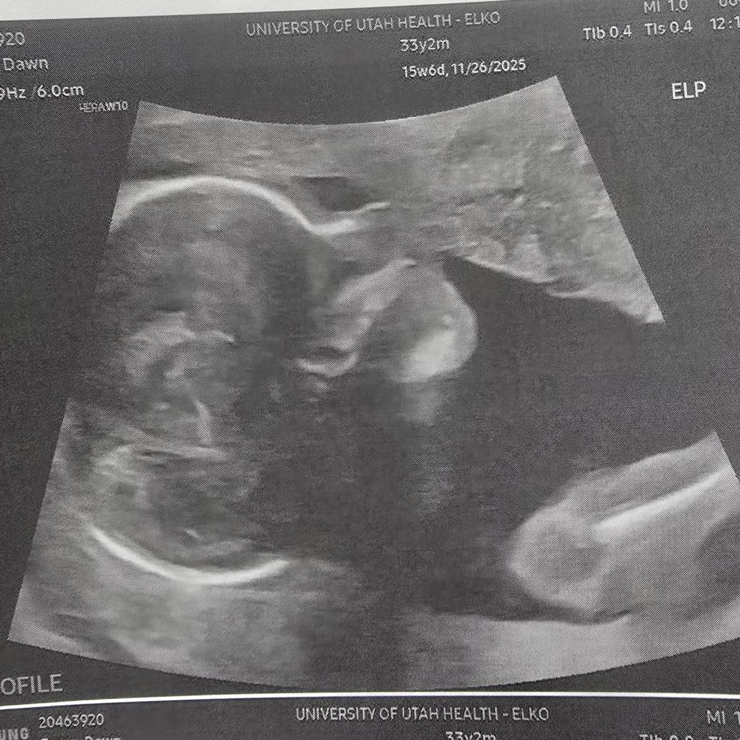 Photo shared by Dawn for their Babylist baby registry.