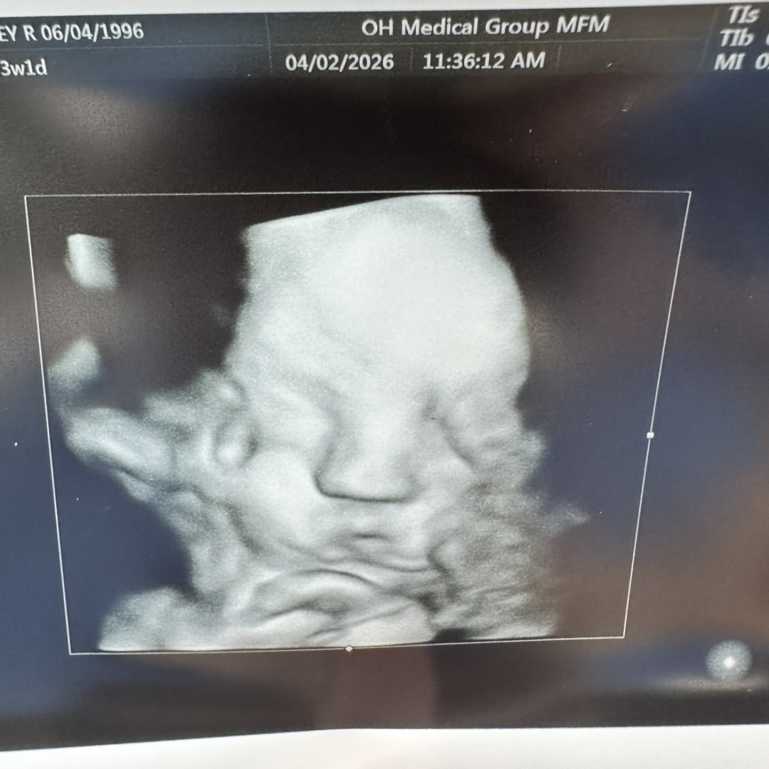 Photo shared by Lacey for their Babylist baby registry.