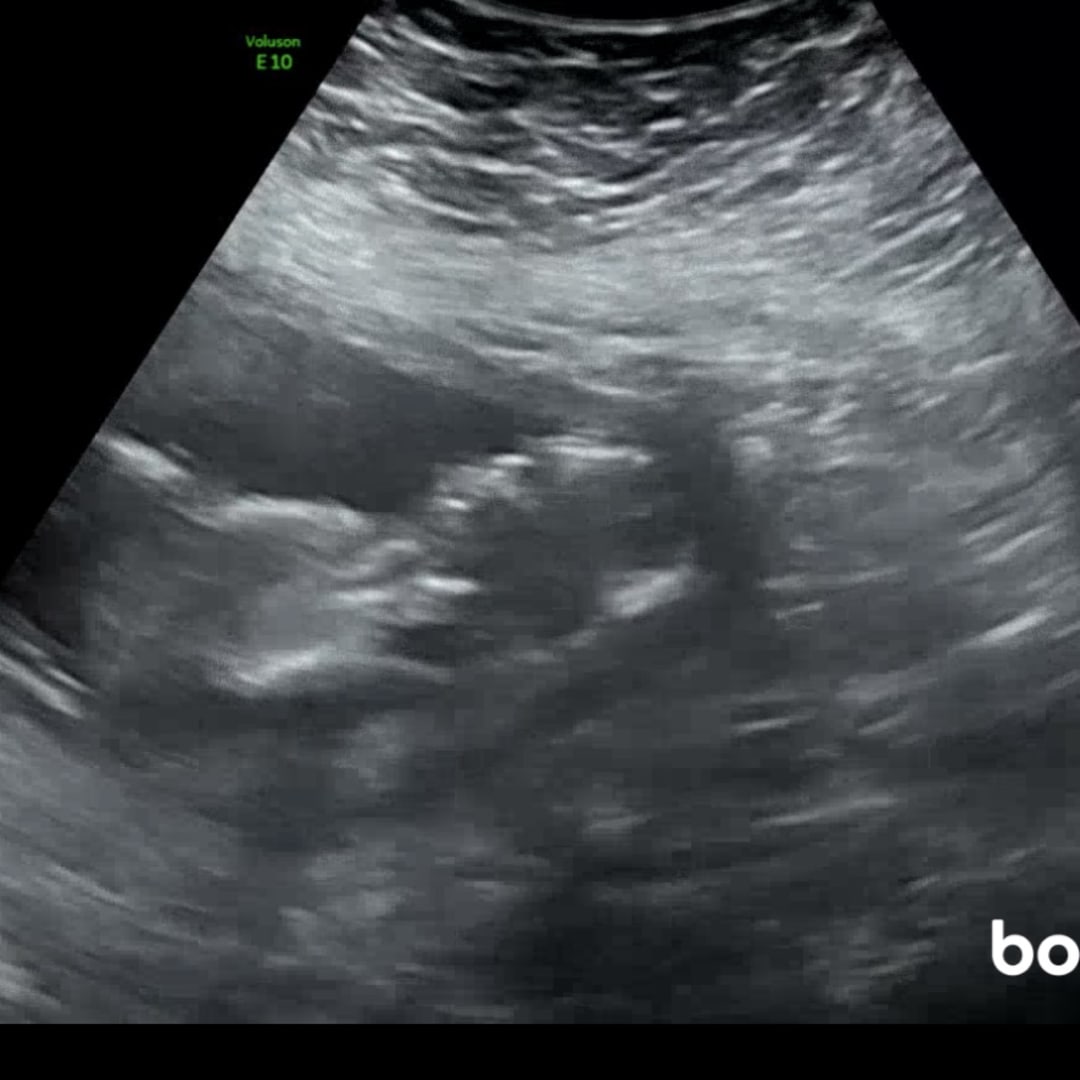 Photo shared by Jennifer for their Babylist baby registry.