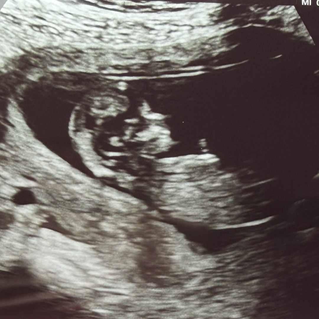 Photo shared by Amanda for their Babylist baby registry.