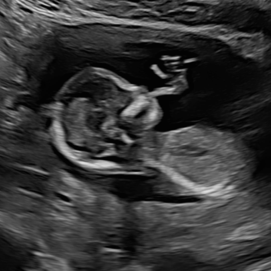 Photo shared by Haley for their Babylist baby registry.
