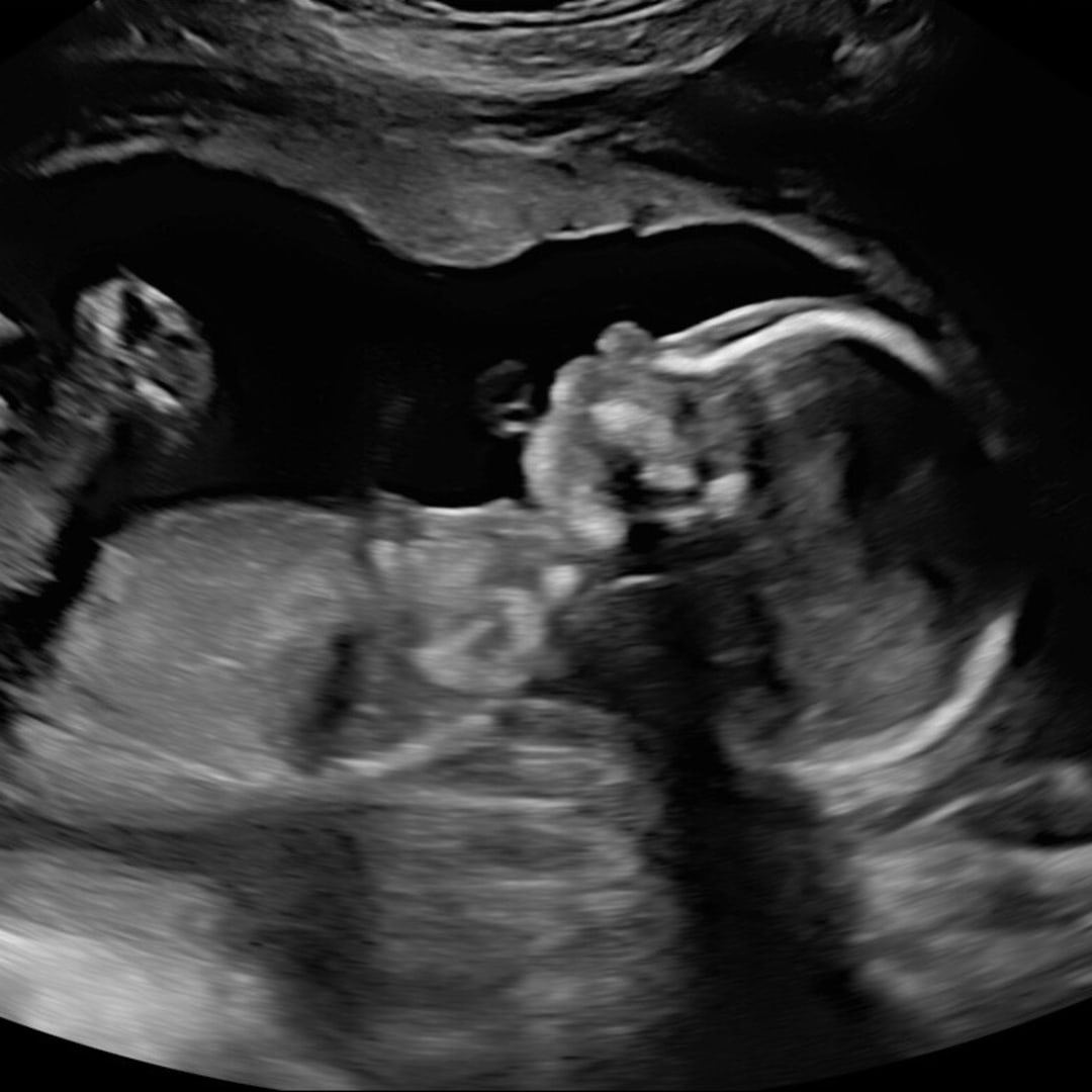 Photo shared by Lily for their Babylist baby registry.