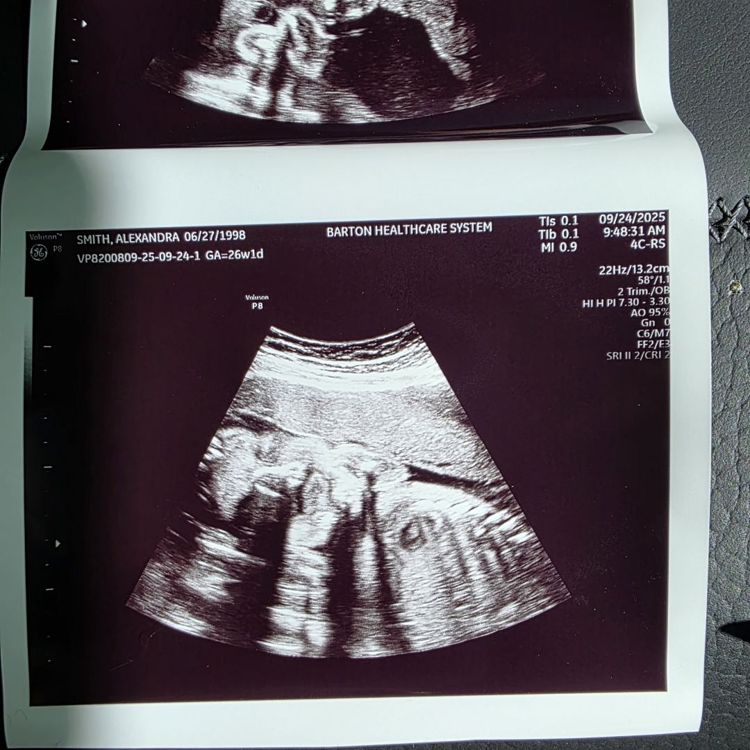 Photo shared by Alex for their Babylist baby registry.