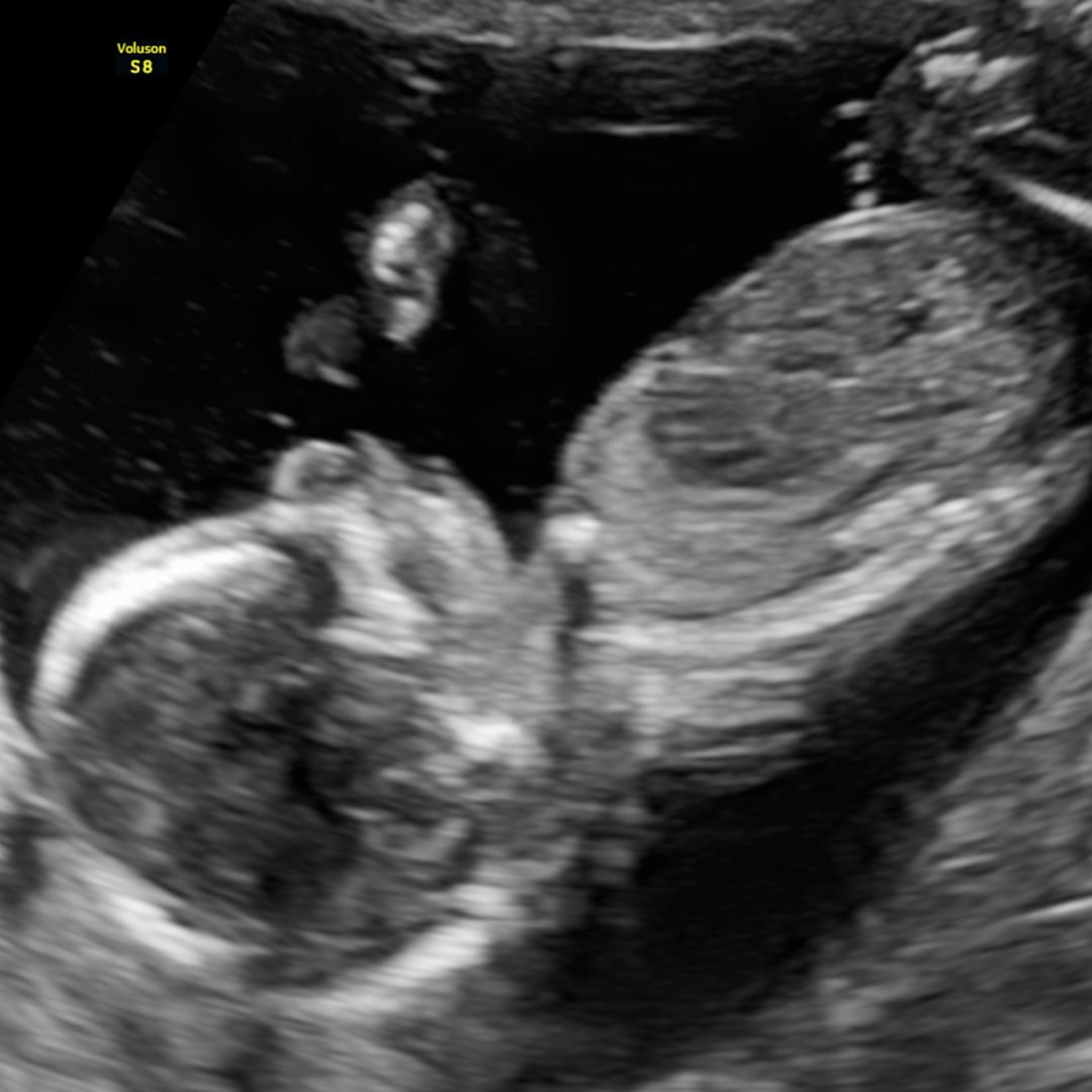 Photo shared by Bailey for their Babylist baby registry.