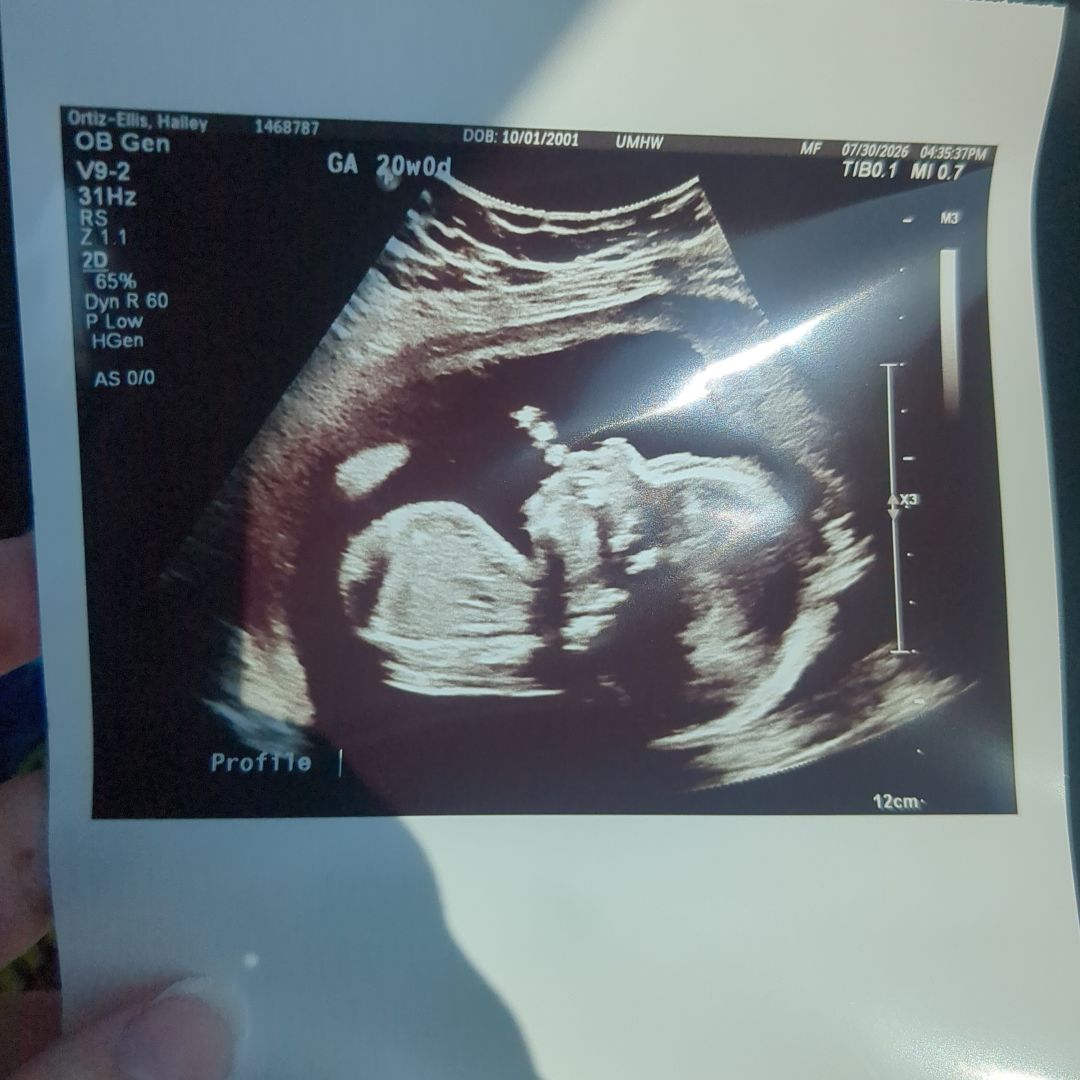 Photo shared by Hailey for their Babylist baby registry.