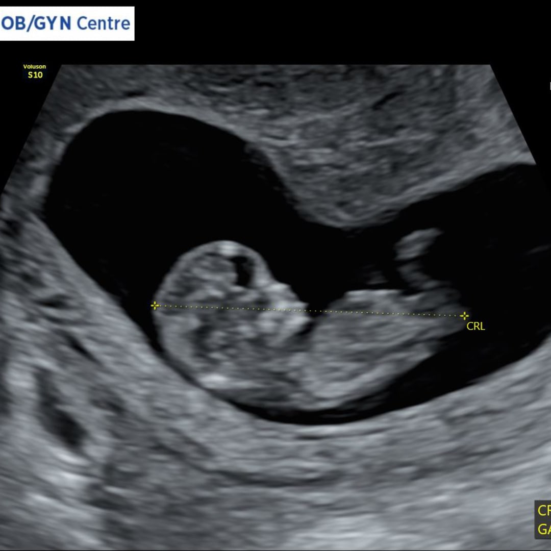 Photo shared by Olivia for their Babylist baby registry.