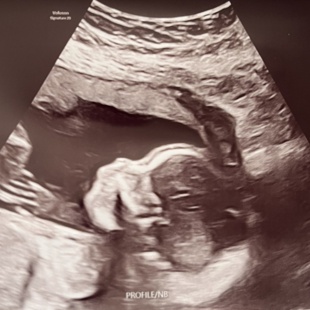 Photo shared by Ava for their Babylist baby registry.