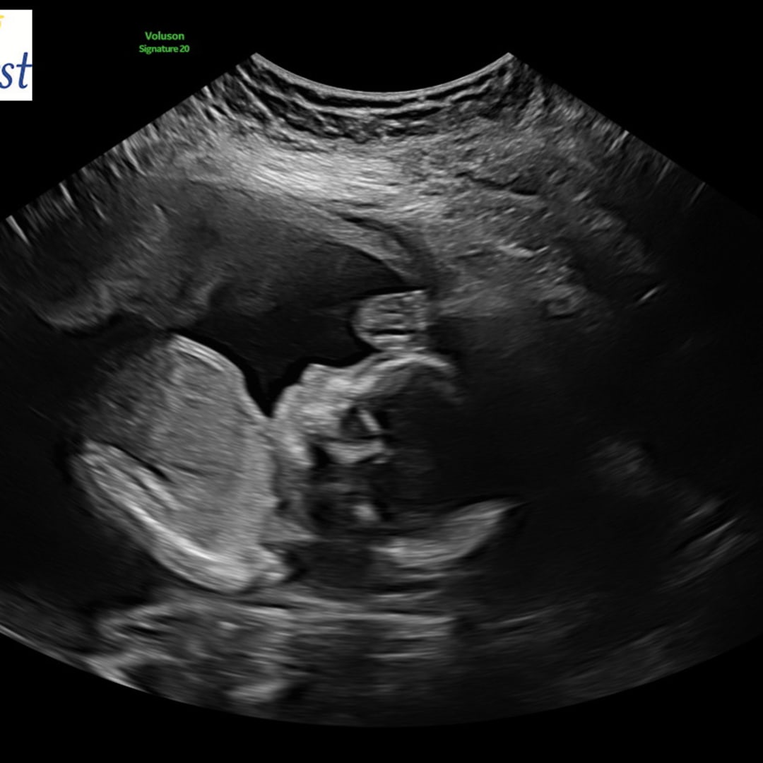 Photo shared by Emily for their Babylist baby registry.