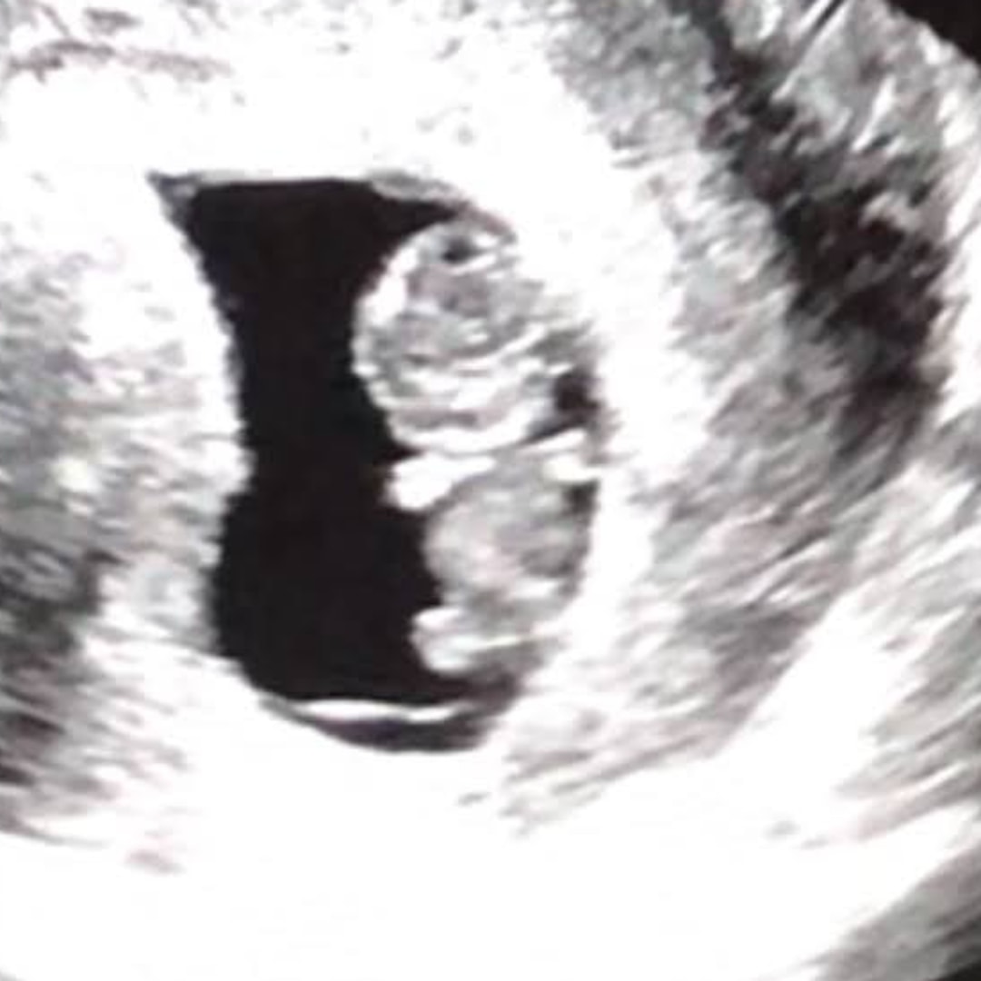Photo shared by Hannah for their Babylist baby registry.