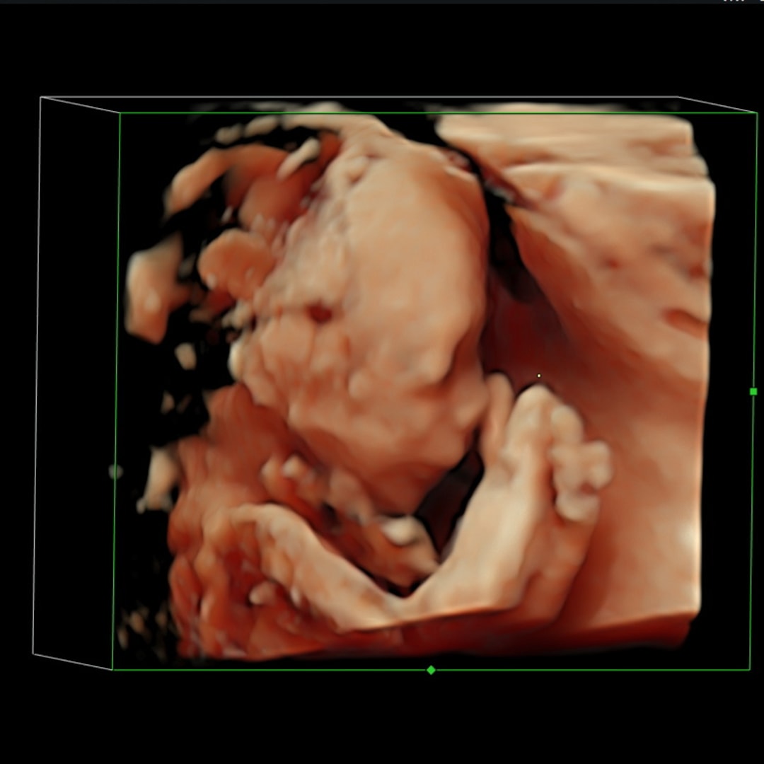 Photo shared by Haley for their Babylist baby registry.