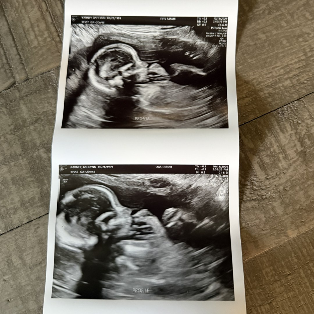 Photo shared by Ashlynn for their Babylist baby registry.
