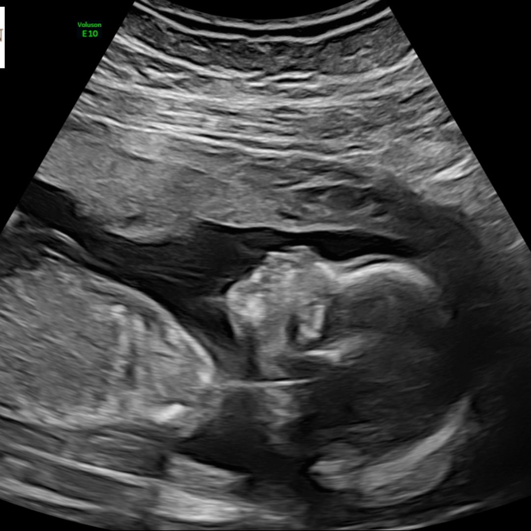 Photo shared by Carley for their Babylist baby registry.