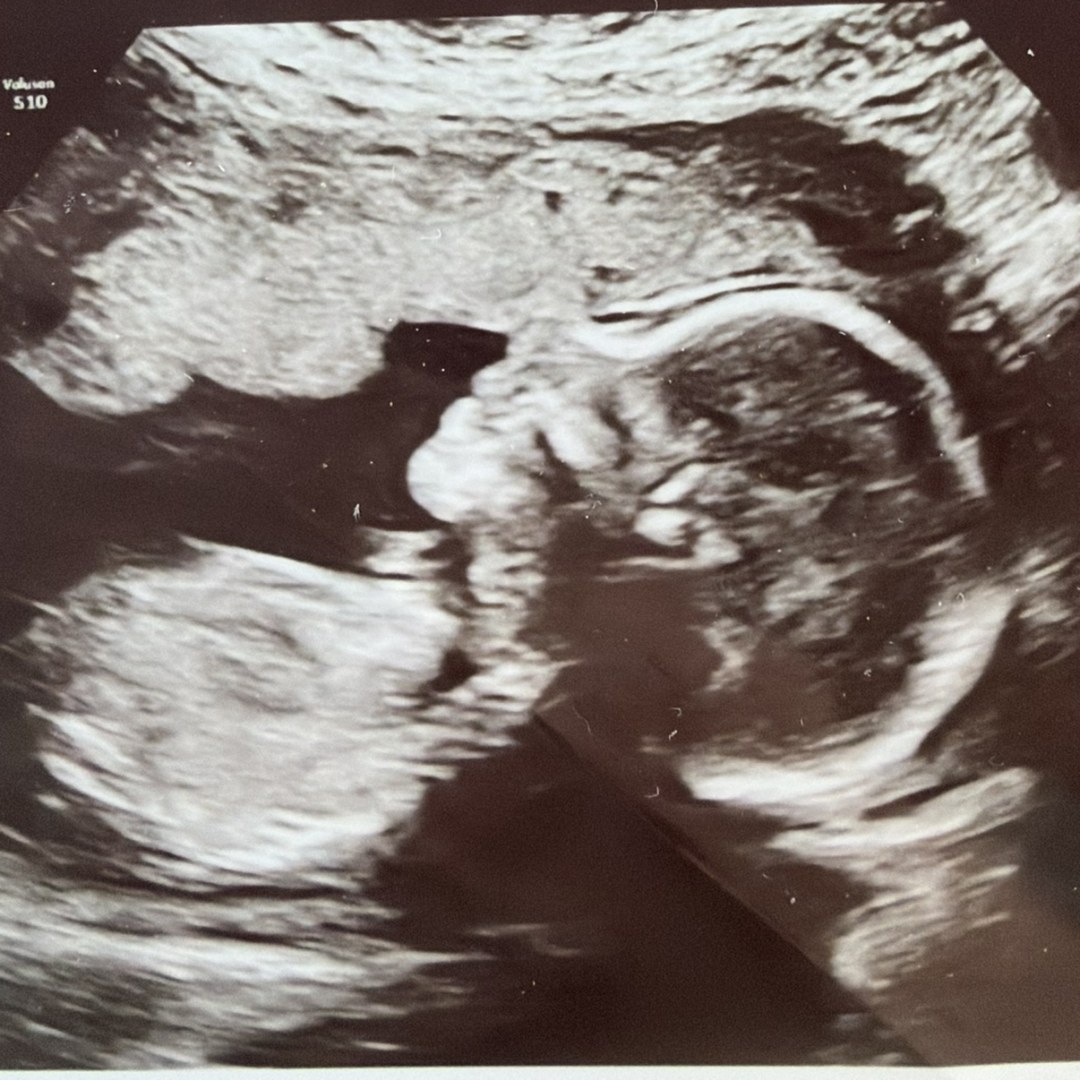 Photo shared by L for their Babylist baby registry.