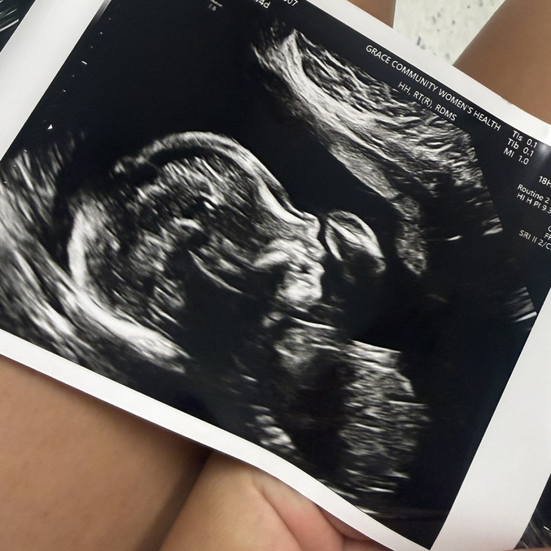 Photo shared by Lacey for their Babylist baby registry.