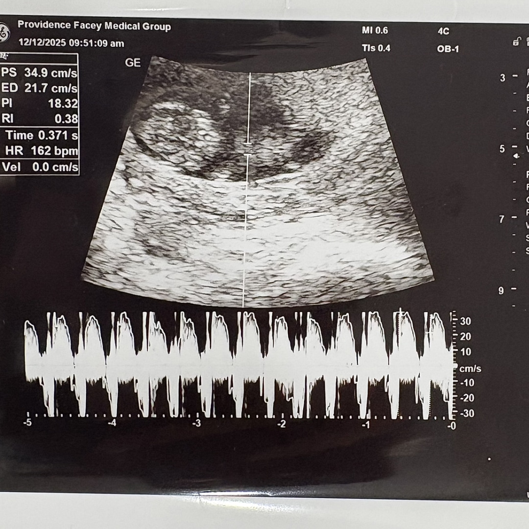 Photo shared by Nayaira for their Babylist baby registry.