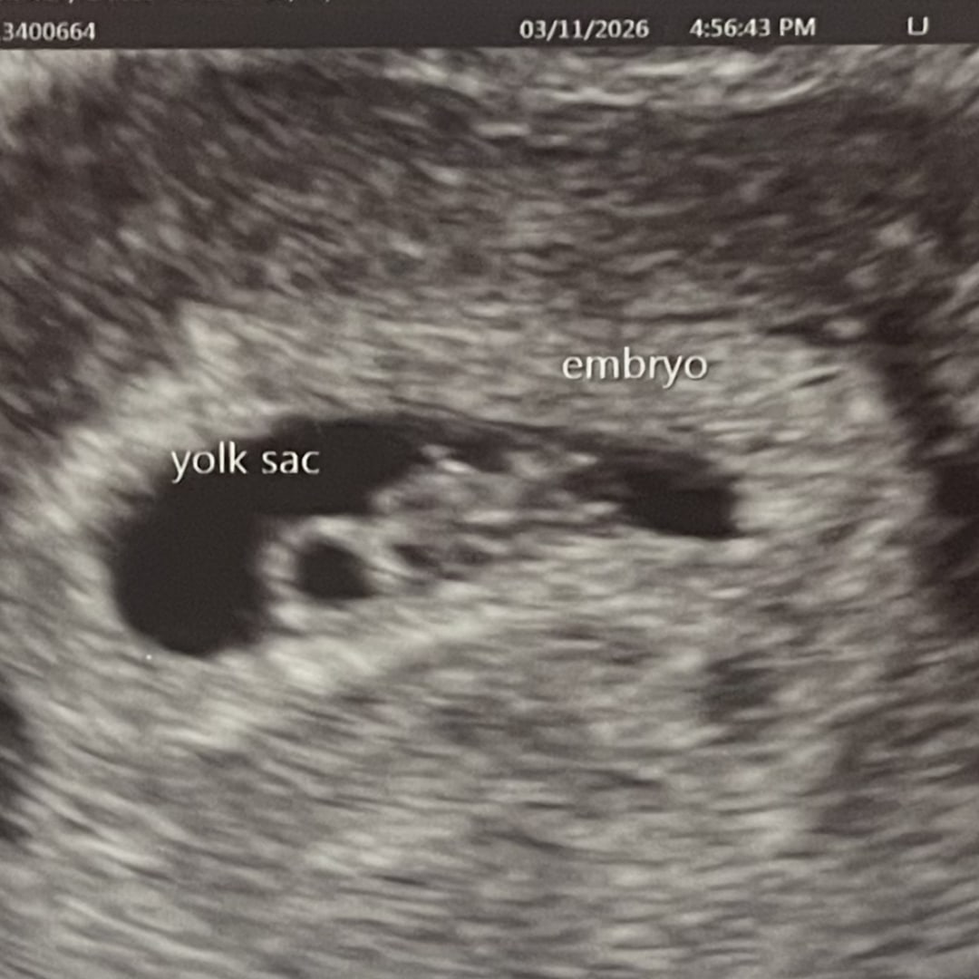 Photo shared by Carley for their Babylist baby registry.
