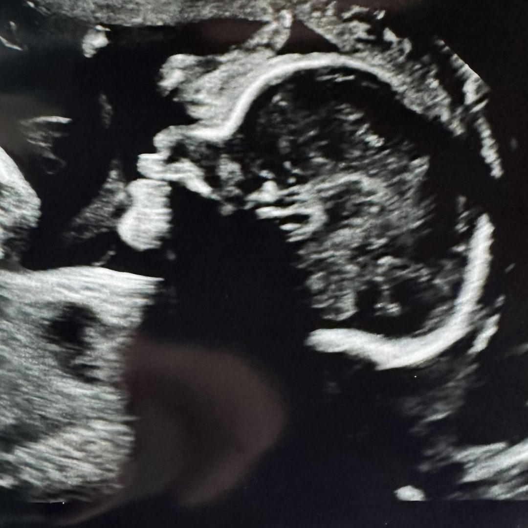 Photo shared by Brianna for their Babylist baby registry.