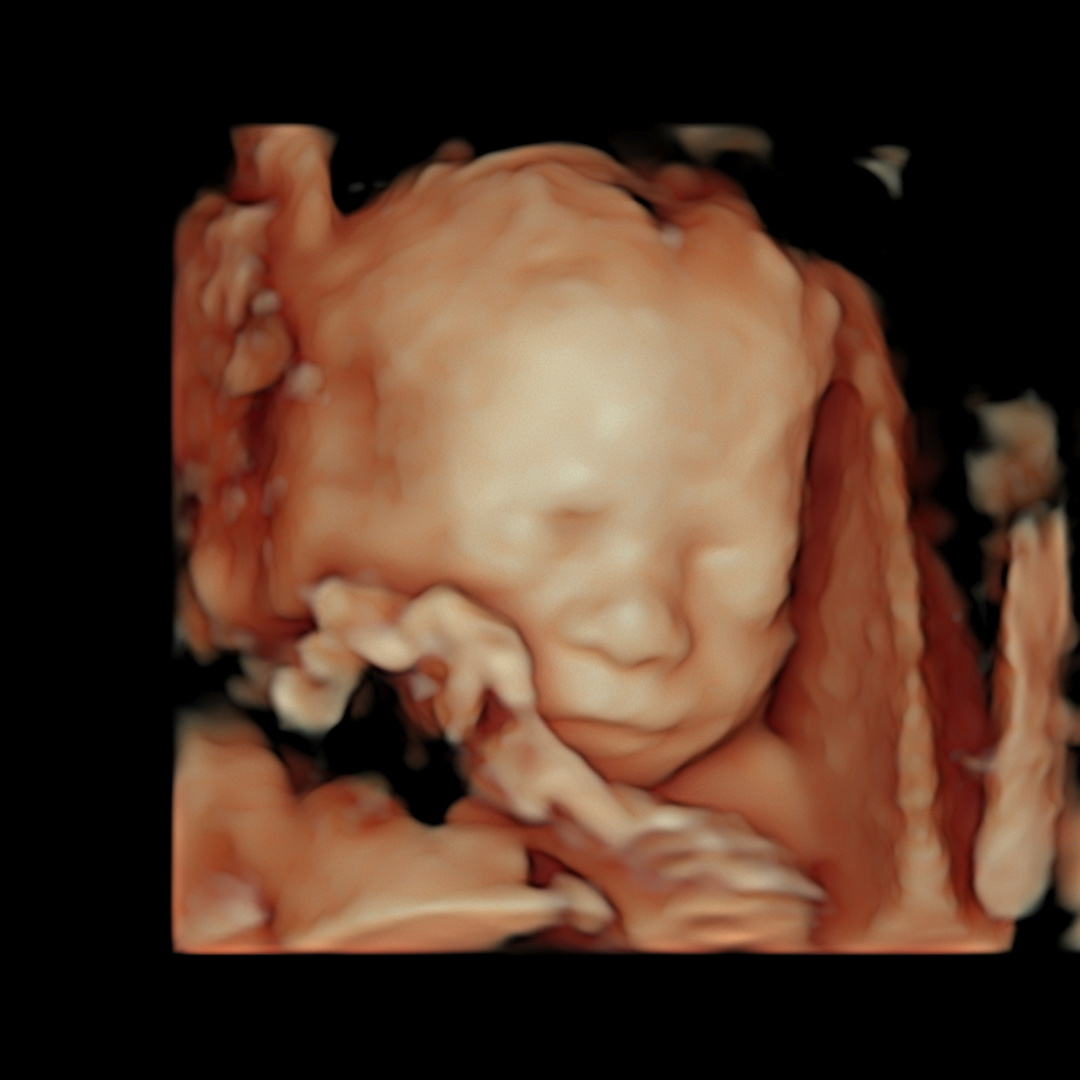 Photo shared by Stephanie for their Babylist baby registry.