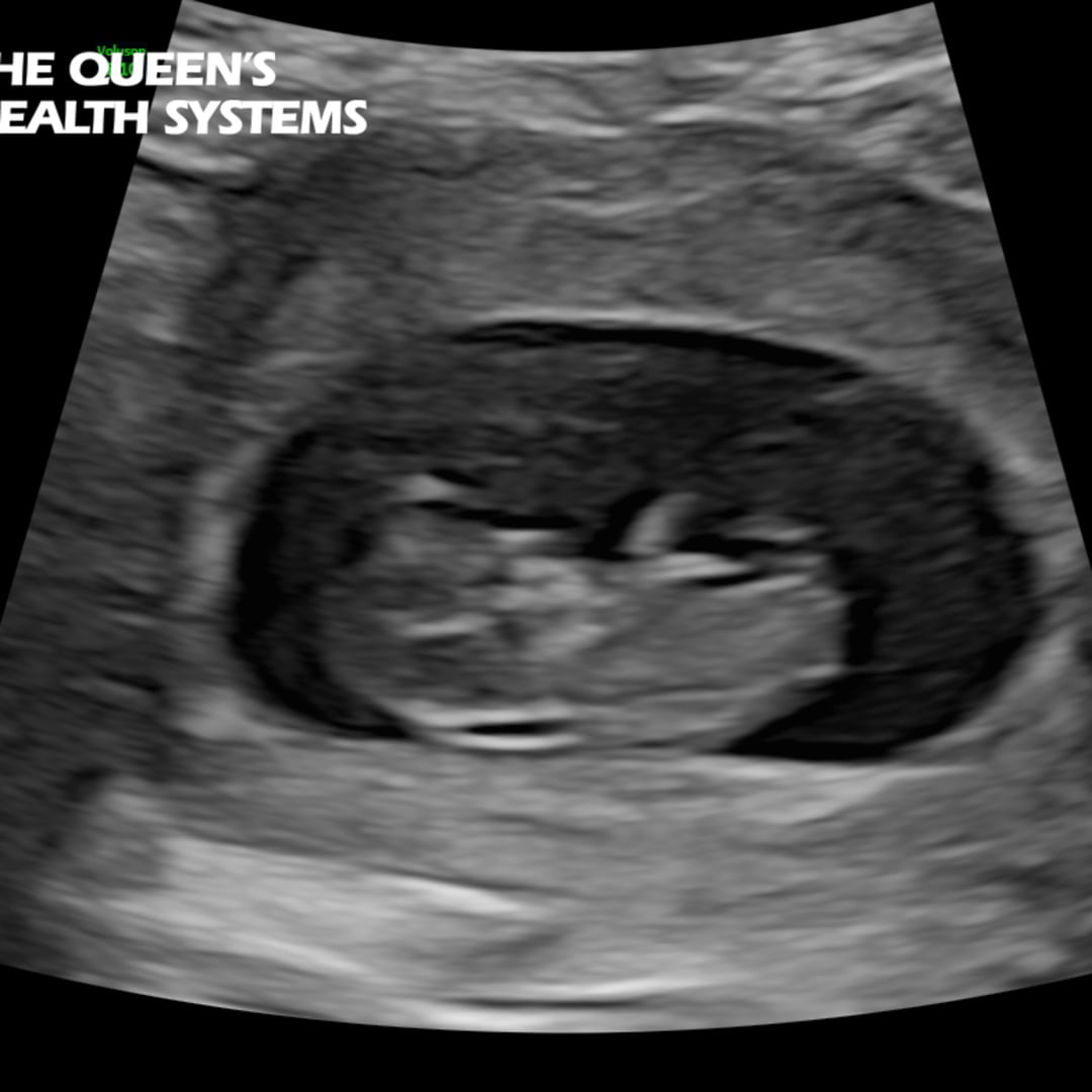 Photo shared by Roxane Grace for their Babylist baby registry.