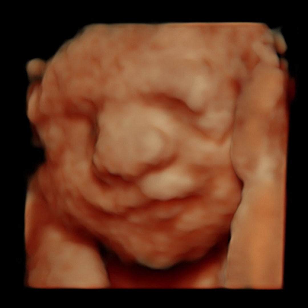 Photo shared by Cassadie for their Babylist baby registry.