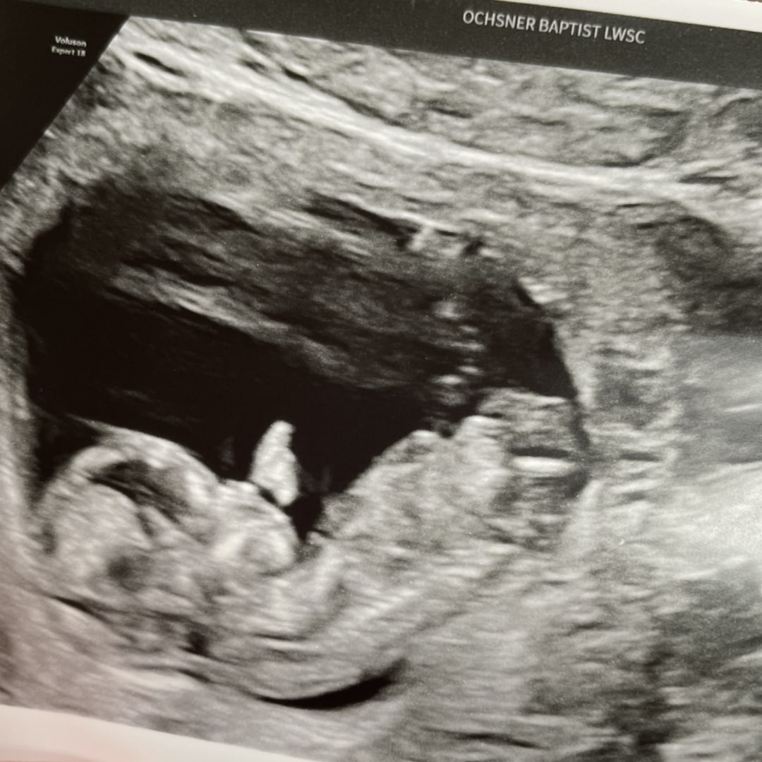 Photo shared by Andraya for their Babylist baby registry.