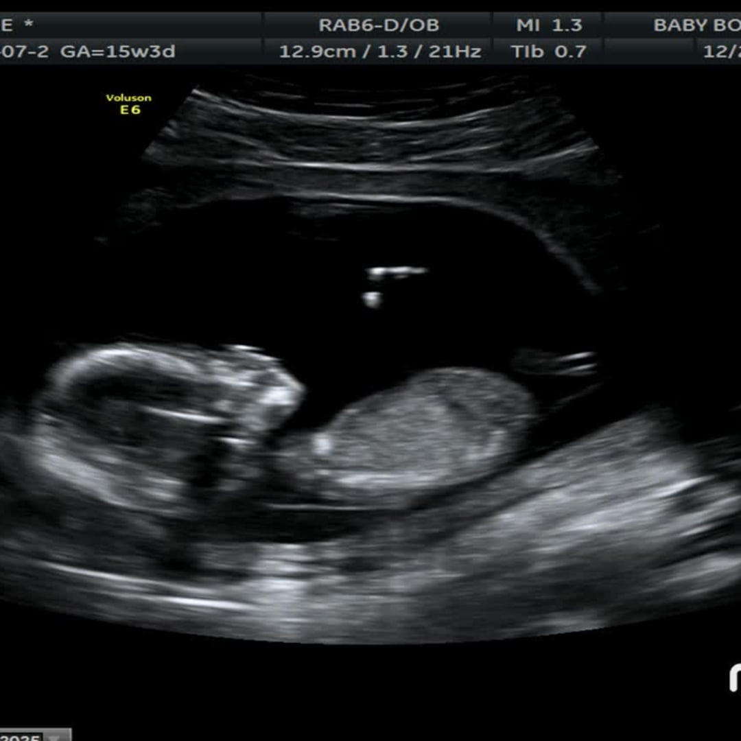 Photo shared by Chloe for their Babylist baby registry.