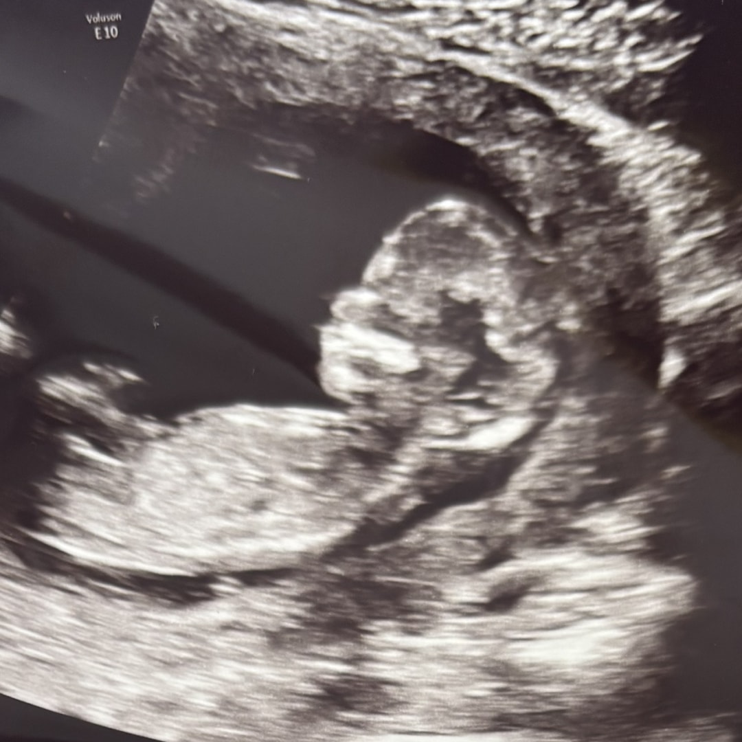 Photo shared by Cassie for their Babylist baby registry.