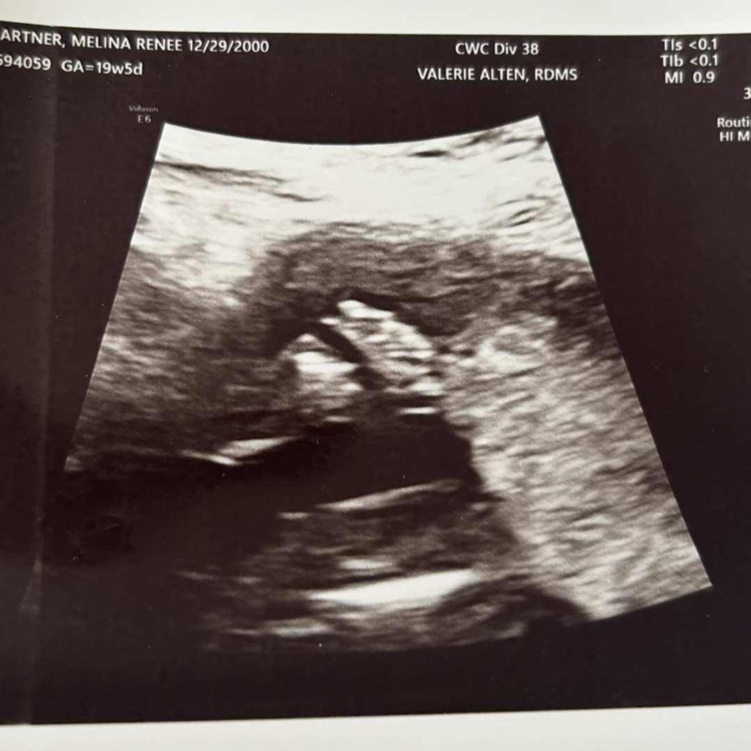 Photo shared by Melina for their Babylist baby registry.