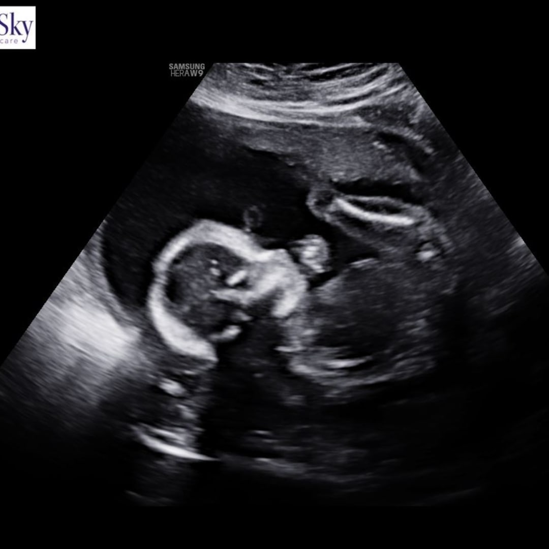 Photo shared by Samantha for their Babylist baby registry.
