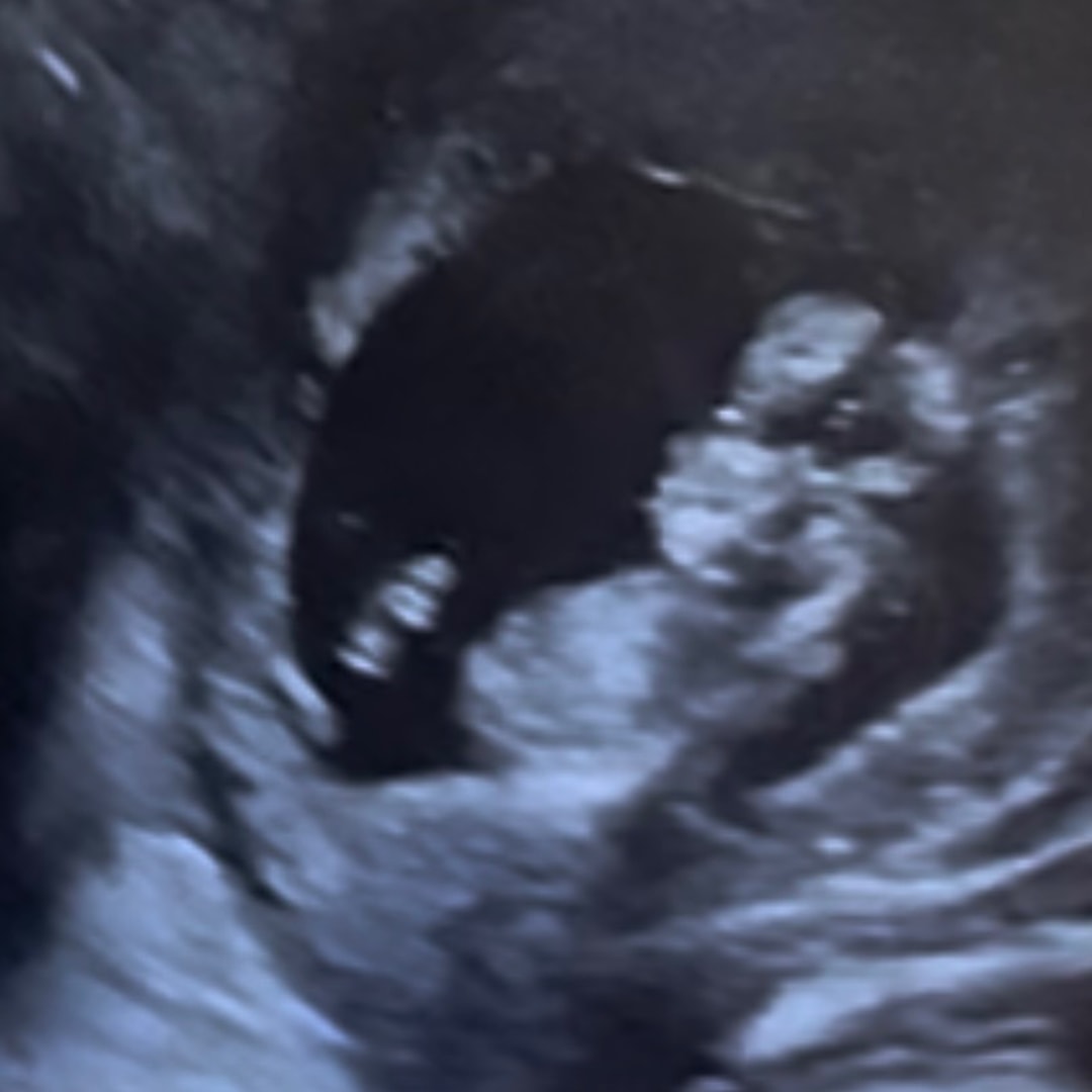 Photo shared by Bunny for their Babylist baby registry.