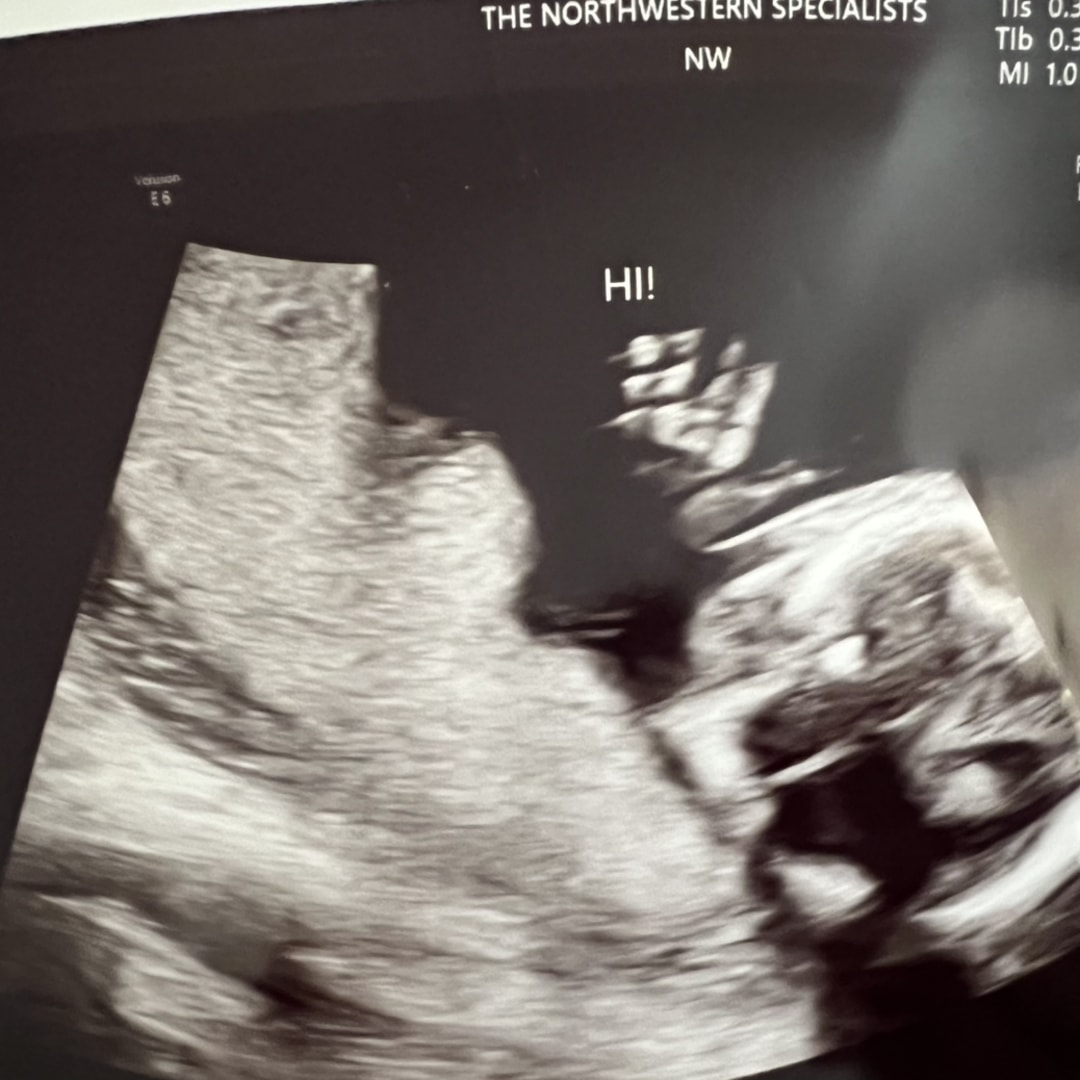Photo shared by Jenna for their Babylist baby registry.