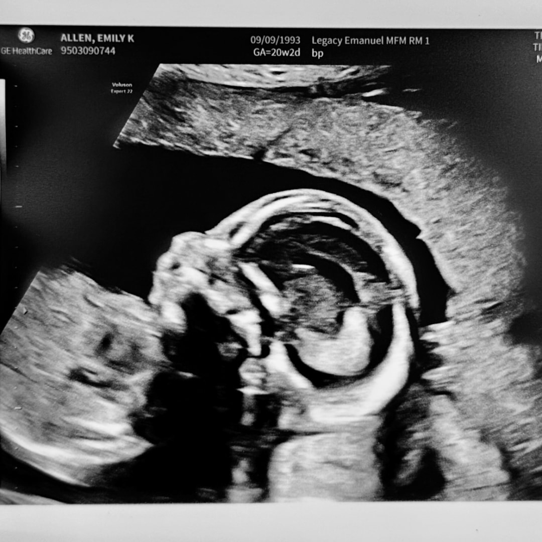 Photo shared by Emily for their Babylist baby registry.