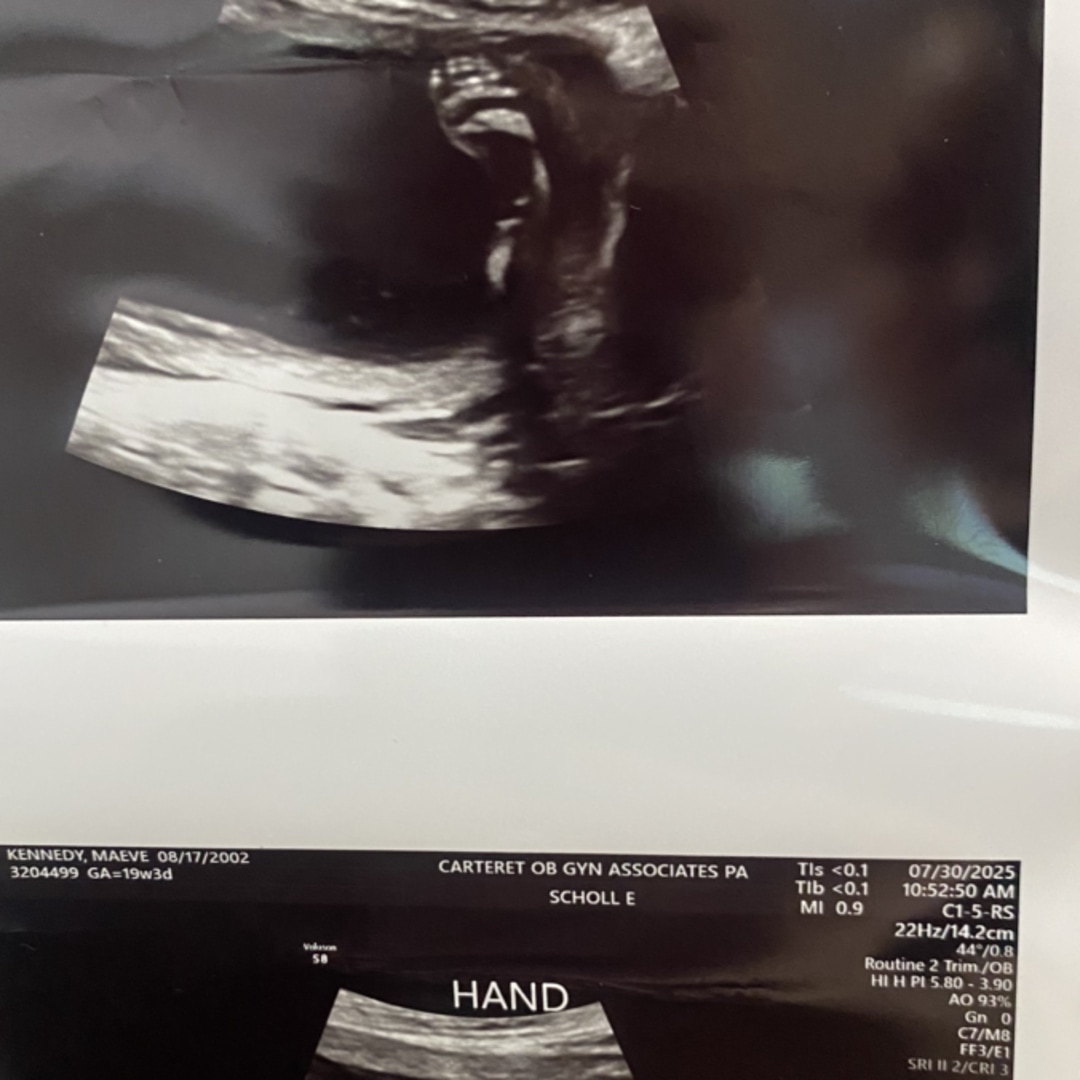 Photo shared by Maeve for their Babylist baby registry.